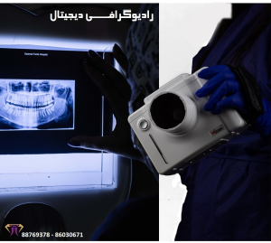 کاربرد عکس OPG